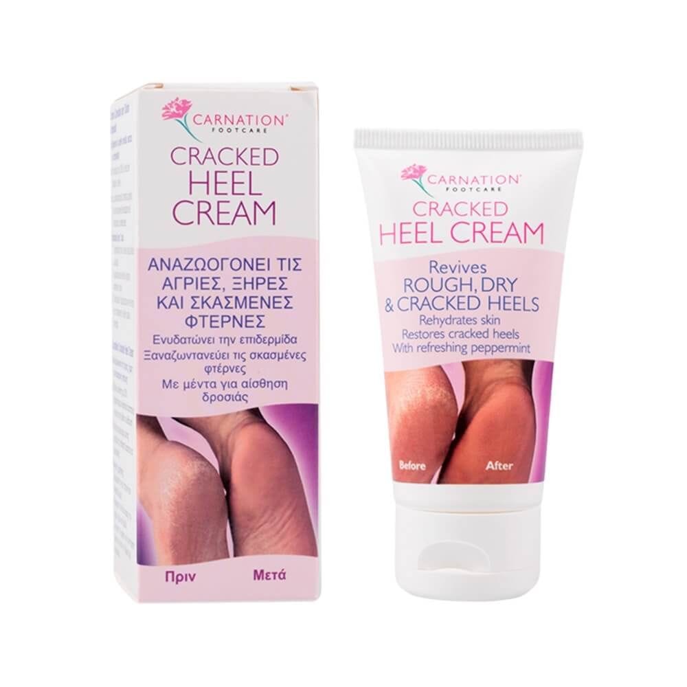 Carnation Footcare Cracked Heel Cream 50ml 1 5012654202353_t20230418163921