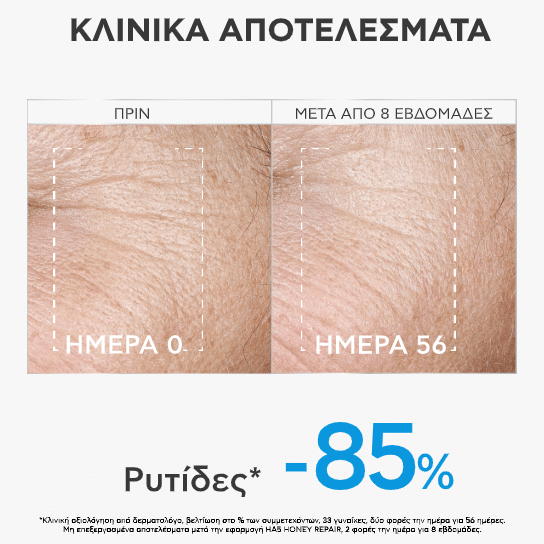 Apivita HA5 Honey Repair Serum 30ml 3 Apivita HA5 Honey Repair Serum 30ml - Image 3