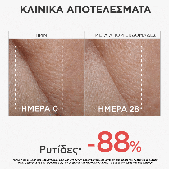 Apivita Ορός C15 Propolis Correct 30ml 3 Apivita Ορός C15 Propolis Correct 30ml - Image 3