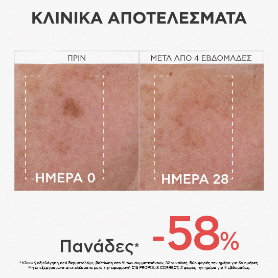 Apivita Ορός C15 Propolis Correct 30ml 4 Apivita Ορός C15 Propolis Correct 30ml - Image 4
